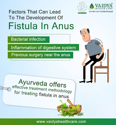 ayurvedic-treatment-for-anal-fistula-in-kerala